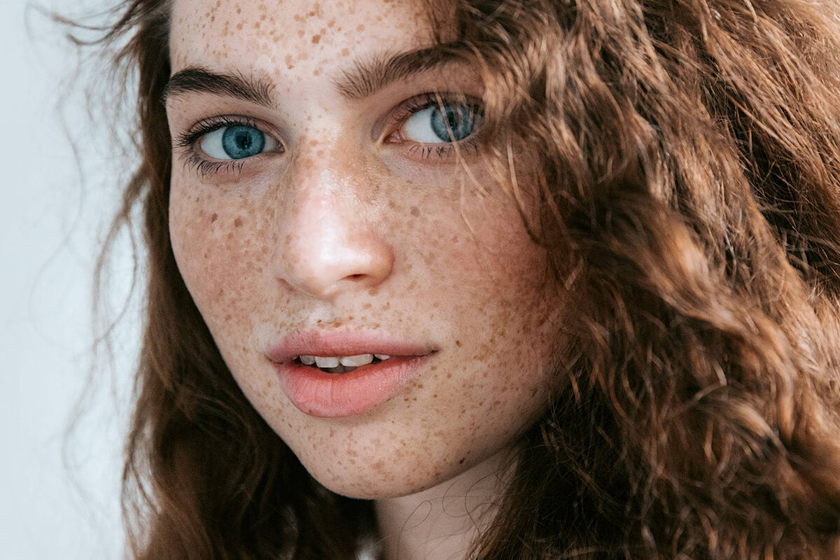 Understanding the Signs of Alopecia in Women